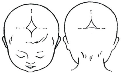 Capul unui nou-născut, forma, mărimea, fontanelul pentru copii - dezvoltarea unui copil de luni de zile