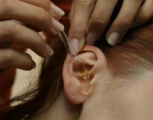 Aplicarea uleiului de camfor în ureche - pot picura
