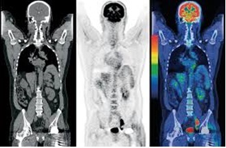 Departamentul de Diagnosticare a Radioizotopilor - Centrul de Cancer Circulator