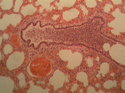 Anatomia patologică a organelor respiratorii ale organelor respiratorii cu caracter inflamator