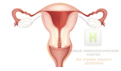 Patologia cavității uterine