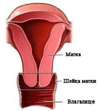 Patologia cavității uterine