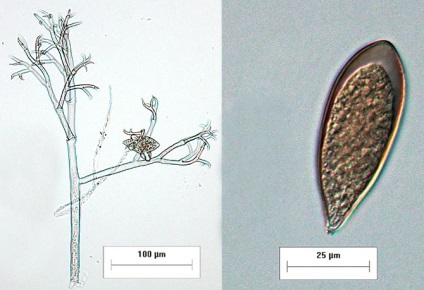 лук peronosporosis