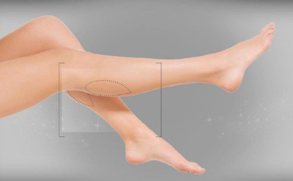 Picior de plastic - face ca forma genunchilor și ghiarelor să fie ideale