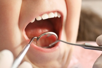 Argintarea dinților este o relicvă a trecutului sau o metodă eficientă