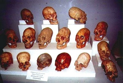 Șocuri tradiționale de ce reprezentanții diferitelor triburi ale lumii au fost implicați în deformarea craniului