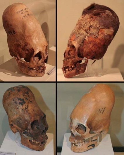 Șocuri tradiționale de ce reprezentanții diferitelor triburi ale lumii au fost implicați în deformarea craniului