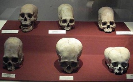 Tradiții șocante de ce reprezentanții diferitelor triburi ale lumii au fost implicați în deformarea craniului