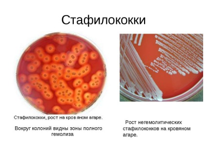 Staphylococcus un copil, în măsura în care este periculos adevărul și miturile despre Staphylococcus aureus