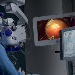 Tehnologii unice, microchirurgie oculară