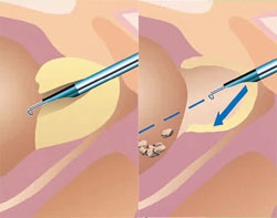 Echipament urologic, echipament medical, ultrasunete, echipament dentar