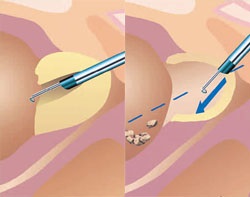 Echipament urologic, echipament medical, ultrasunete, echipament dentar