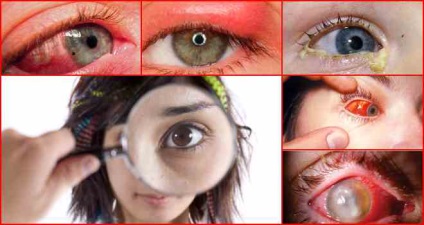 Inflamația ochiului la ce patologii apare și cum se tratează