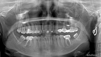 Notele medicului dentist sunt cei mai ciudați clienți sau 