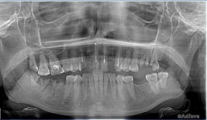 Notele medicului dentist sunt cei mai ciudați clienți sau 