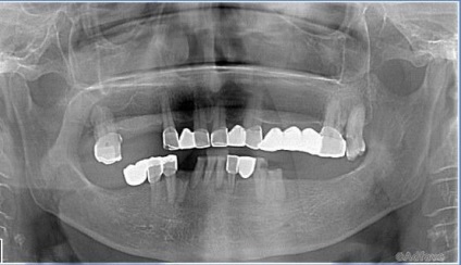 Notele medicului dentist sunt cei mai ciudați clienți sau 