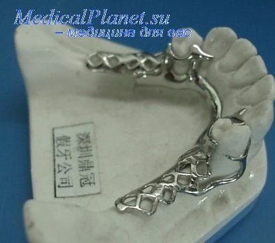 Finalizarea protezelor pe maxilarul fără dinți