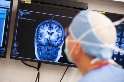 11% Pacienții care suferă de accident vascular cerebral suferă de epilepsie