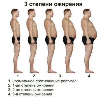 Tipul abdominal de tratament al obezității - scăpați de obezitate și pierdeți în greutate