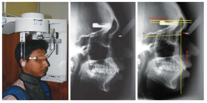 Revista dentară, articole, ortopedică, conceptul poziției naturale a capului în stomatologie Prezentare generală