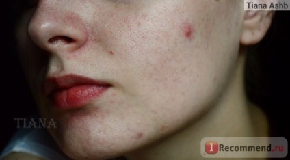 Exfoliant pentru masca cu smântână cu mască cu acizi de fructe - 