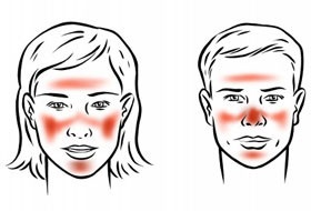 Hogyan gyógyítsuk meg a rosaceát az arc táplálkozásán, maszkján, jogorvoslatán