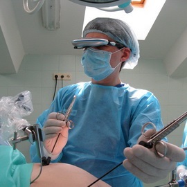 Atunci când este necesară o operațiune pentru a elimina metodele de micomanie uterină pe video, consecințele posibile în