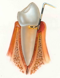 Hippokratész orvosi központ, parodontológia