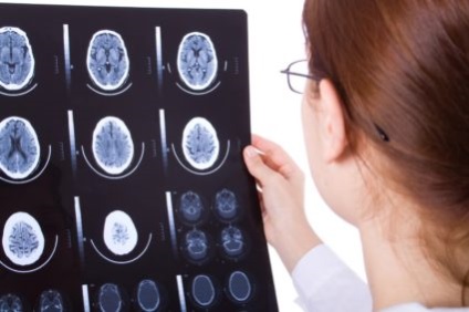 Meningiomul creierului - cauze și opțiuni pentru vindecare