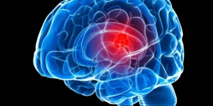 Az agy meningioma - a gyógyulás okai és lehetőségei