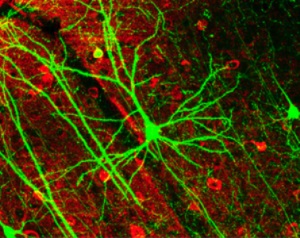 Neuromotonia - simptome, cauze de dezvoltare, tratament