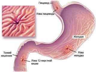 Examinarea stomacului care arată și indicații pentru