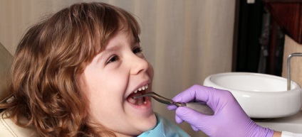 Principalele avantaje ale dentistului plătit olis-dent în Kirovo-Chepetsk