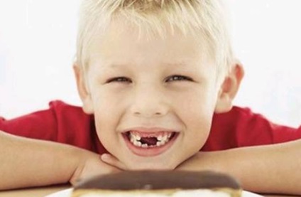 A fogorvosi fogak pótlásának jellemzői és időzítése állandó, hasznos cikkekkel a gyermekgyógyászatban