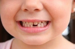Caracteristicile dinților copilului care dispar și schema schimbării lor este constantă, ce să atragă