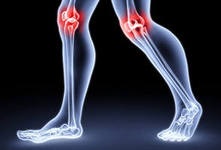 Osteoartrită a tratamentului articulației genunchiului cu remedii folclorice, tratament cu remedii folclorice