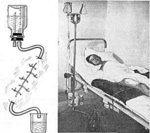 Tratamentul chirurgical primar al rănilor