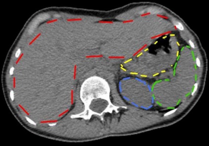 Decodarea cancerului pulmonar, 1 răspuns, 38 de comentarii, forumul de consultare 