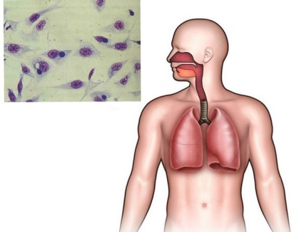 Chlamydia respiratorie provoacă, simptome și tratament