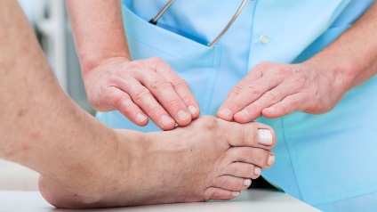Conuri de pe picioare cauze și tratament sunt modalități de a scăpa de