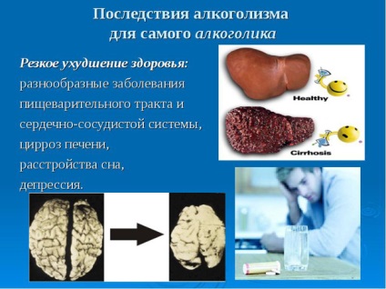 Korsakov sindrom de cauză, principiile de tratament și de diagnostic