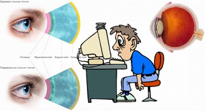 Sindromul ochilor uscați, cauzele și tratamentul remediilor populare