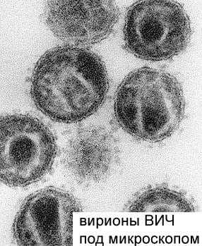 Structura HIV