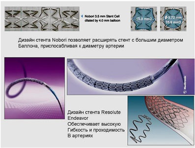 Instalarea stenturilor vaselor coronare și arterelor