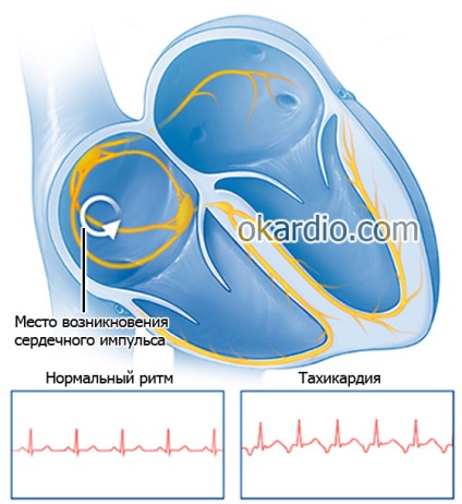 Toate simptomele și semnele insuficienței cardiace la bărbați