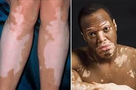 Medicamentul de Est consideră că cauzele bolilor de piele