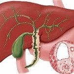 Cholagogue remedii populare pentru ierburi de la stagnarea de bile, medicina populara