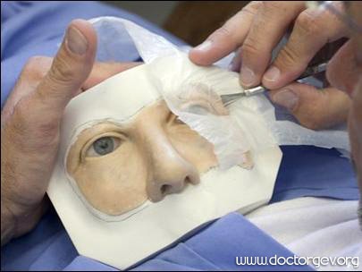 O femeie a făcut o față siliconică