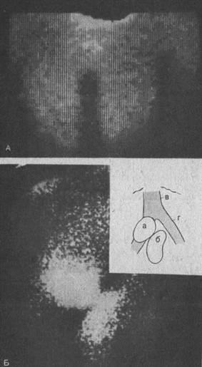 Anomalii ale testiculelor (monarhism, anarhism, poliarhism, criptorhidism)