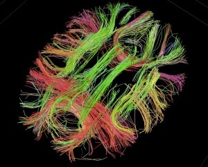 Modelul comportamental, etiologia